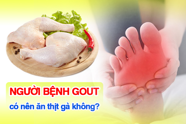 Người bệnh Gout có nên ăn thịt gà không?
