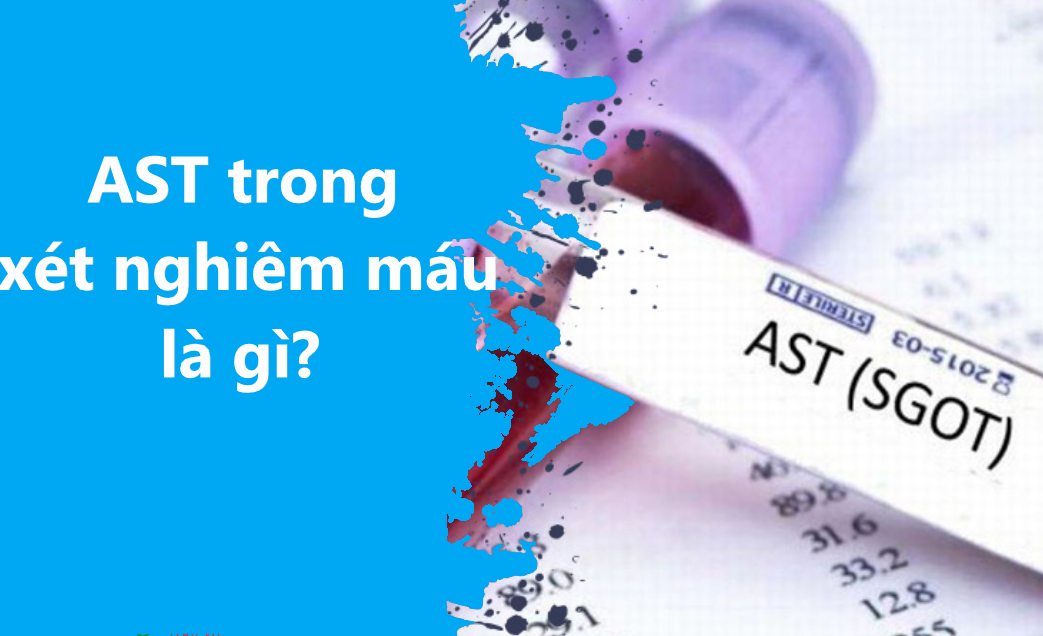 AST trong xét nghiệm máu là gì? AST cao có phải bị bệnh gan không?