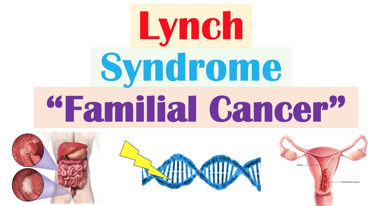 Hội chứng Lynch là gì? Những thông tin mà bạn cần biết