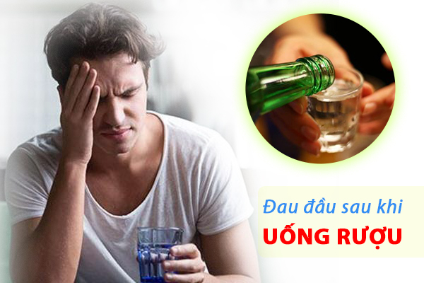 Xử lý cơn đau đầu sau khi uống rượu bằng cách nào?