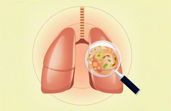 Khi nào cần giải độc phổi? 