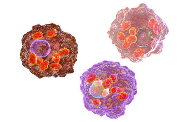 Đại thực bào phế nang bắt nhốt và tiêu diệt các tác nhân gây bệnh cho phổi