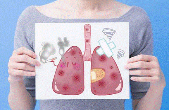 Nguyên nhân nhiễm độc phổi là gì?