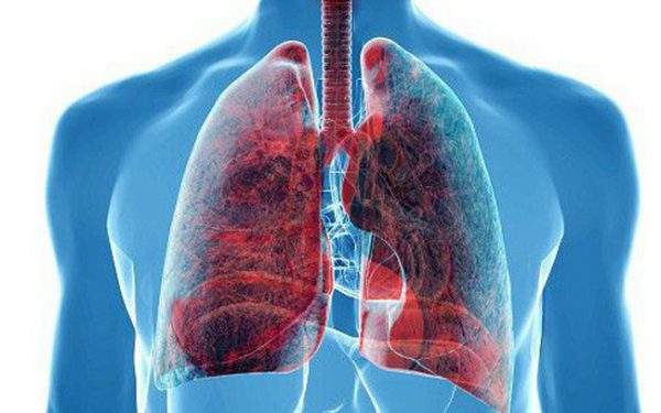 Hút thuốc lá gây nhiều bệnh lý trên đường hô hấp, nghiêm trọng nhất là ung thư phổi