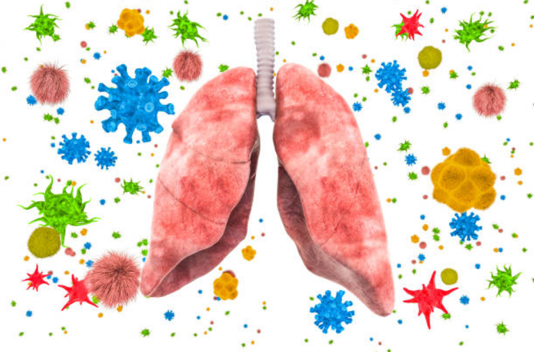 Phổi bị nhiễm độc là nguyên nhân hàng đầu gây các bệnh lý tại phổi