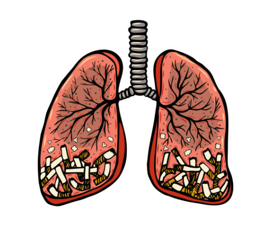 Một số tác nhân gây nhiễm độc phổi