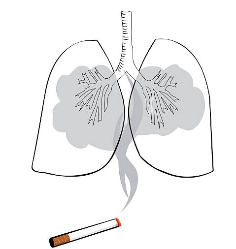  Khói thuốc lá là nguyên nhân hàng đầu gây bệnh viêm phổi tắc nghẽn mãn tính