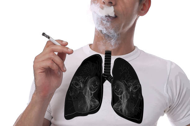 Hút thuốc lá làm tăng nguy cơ ung thư phổi