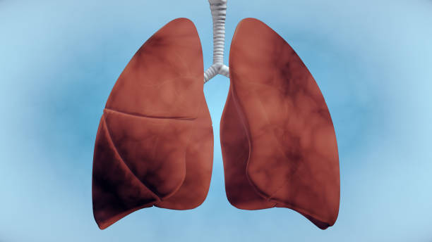 Nhiễm độc phổi là yếu tố hình thành và làm nặng thêm bệnh hen suyễn