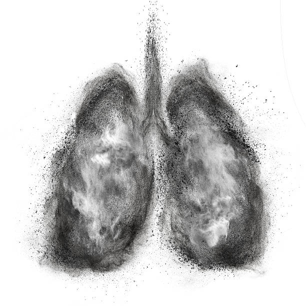 Nhiễm độc phổi làm tăng nguy cơ mắc bệnh hen suyễn