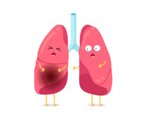 Nhiễm độc phổi không chỉ gây ho khạc đờm mà còn có thể tiến triển thành các bệnh lý liên quan đến phổi