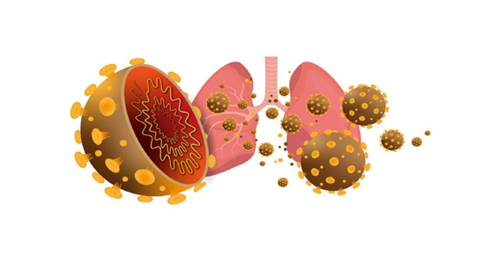 Virus SARS- CoV-2 tấn công lá phổi của bạn như thế nào? Giải pháp nào giúp bảo vệ phổi tối ưu?