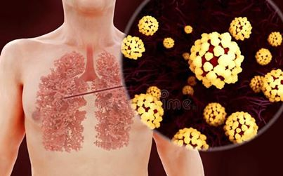 Khi bị virus SARS-CoV- 2 tấn công, lá phổi khó có thể hồi phục