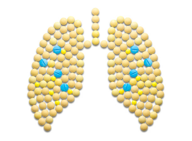 Thuốc bổ phổi cho người bị lao phổi nào tốt nhất?