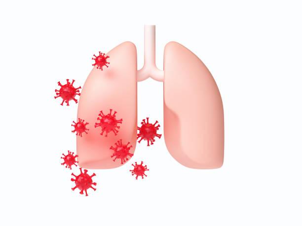 Các chất độc tích tụ trong lá phổi là tác nhân thúc đẩy đợt cấp COPD tái phát