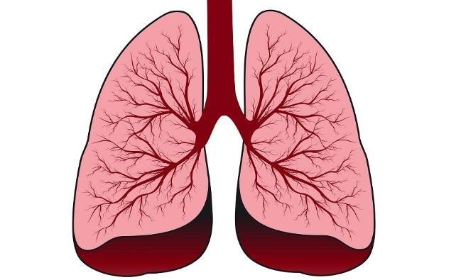Ở người cao tuổi bị viêm phế quản mãn tính, khả năng hồi phục và bảo vệ của phổi bị suy giảm