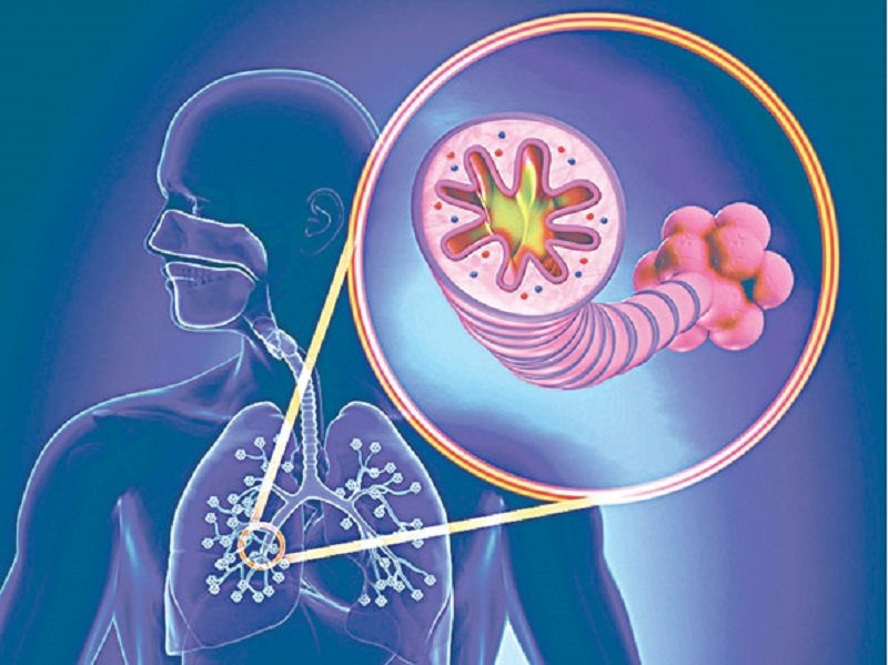 Những đối tượng có nguy cơ cao mắc phải COPD và cách phòng bệnh hiệu quả