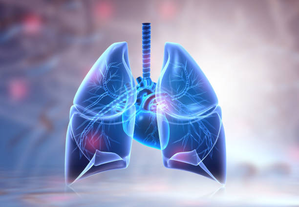 Thải độc phổi cho người bệnh hô hấp mạn tính bằng cách nào?