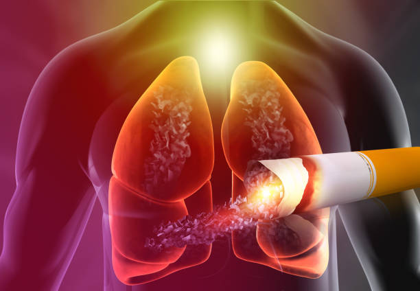 Khi phổi đã bị nhiễm độc nghiêm trọng thì bạn cần áp dụng cách làm sạch phổi