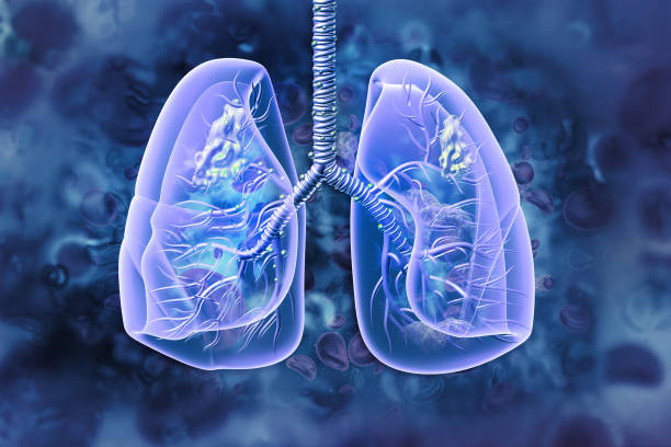 Nếu phổi có tiếng ran rít, ran ngáy thì chứng tỏ bệnh đã sang giai đoạn nặng
