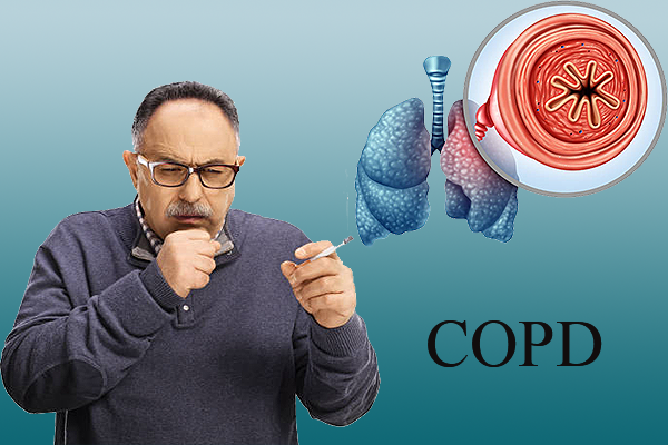 Tiêu chuẩn chẩn đoán COPD là gì?