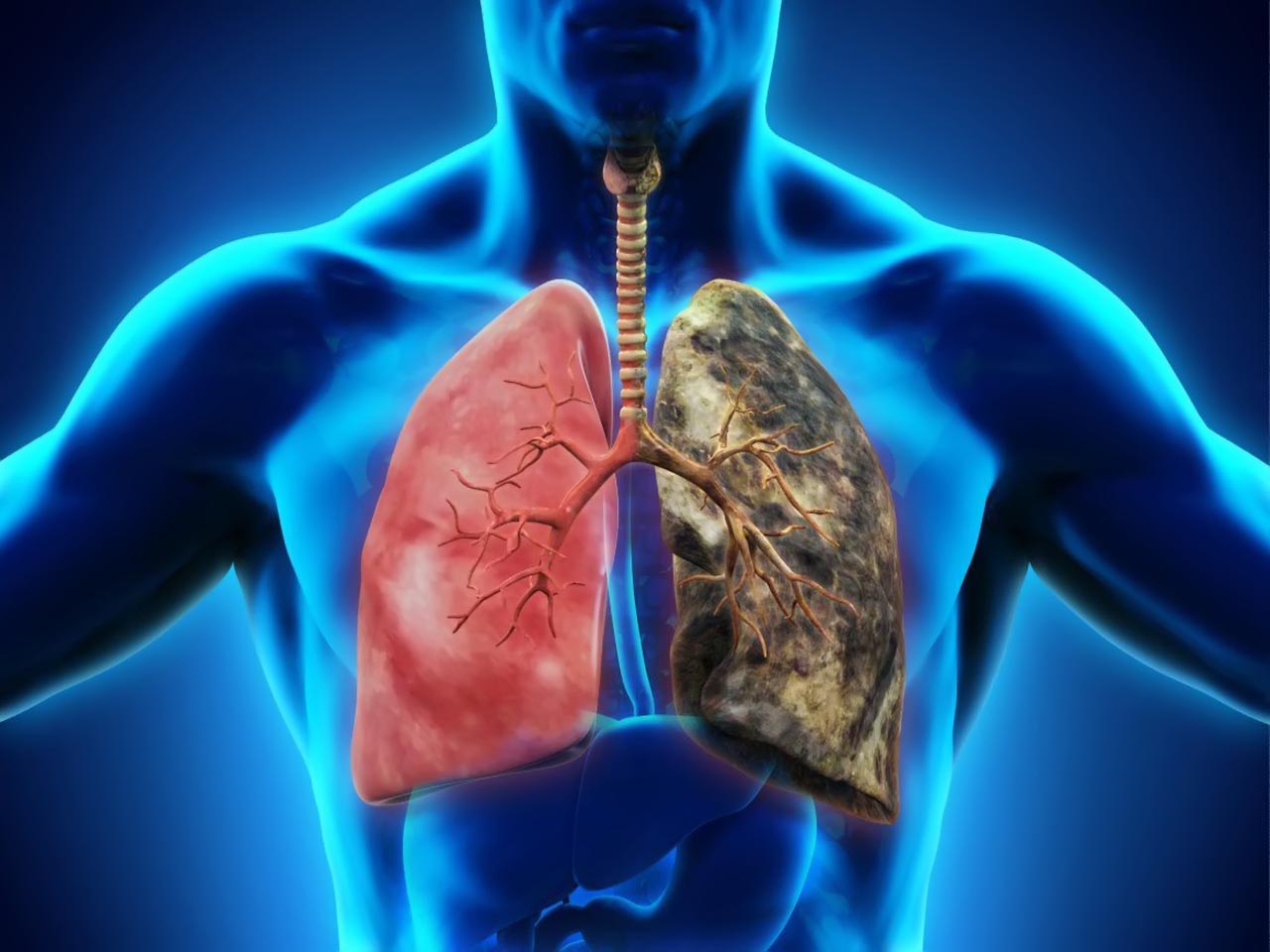 Các tác nhân gây bệnh tích tụ gây nhiễm độc phổi