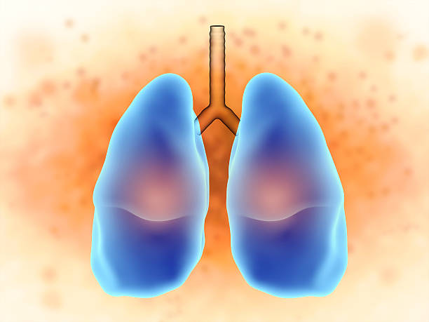 Giải độc phổi cho người bệnh khí phế thũng bằng cách nào?