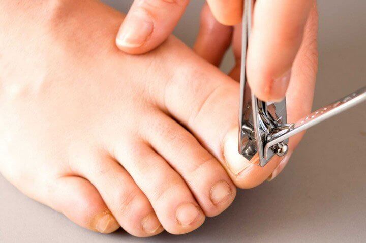 Người bệnh tiểu đường cần đặc biệt cẩn thận khi cắt móng chân