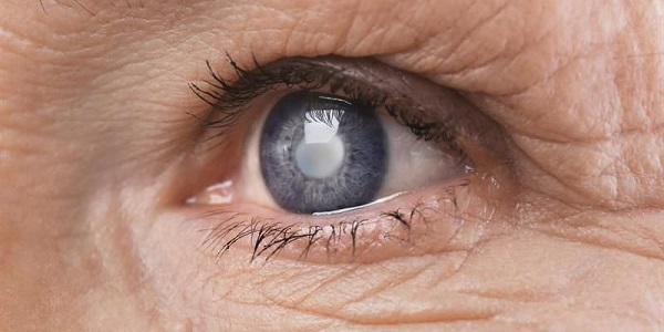 Mắt bị mờ như có màng che có phải dấu hiệu cảnh báo bệnh tiểu đường?