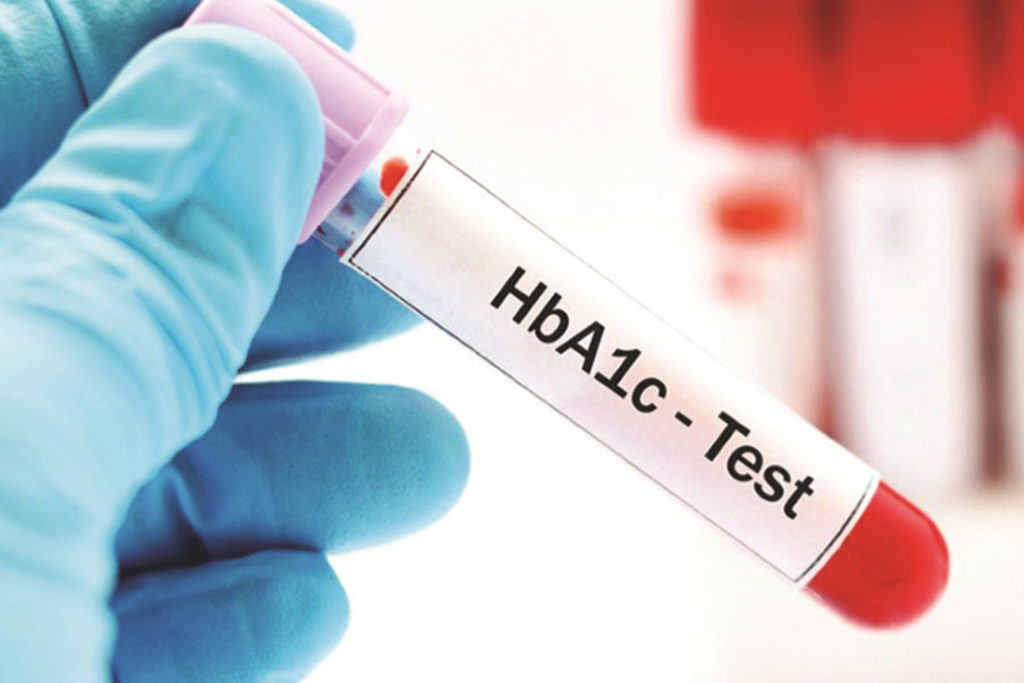 Kiểm tra chỉ số HbA1c để chẩn đoán bệnh tiểu đường