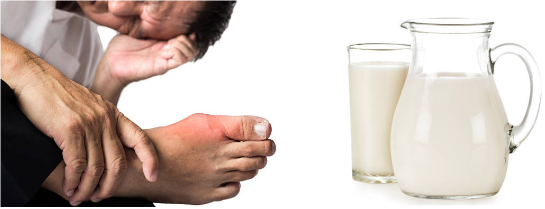 Người bệnh gút có uống sữa được không? 5 Loại đồ uống tốt cho người bệnh gút