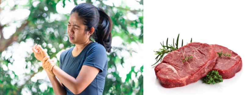 Người bệnh gút ăn thịt bò được không? Họ nên ăn và cần kiêng loại thực phẩm nào?