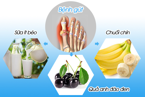 Các thực phẩm tốt cho người bệnh gout là gì?