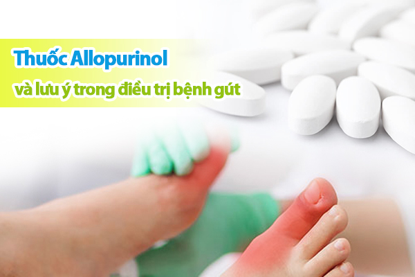 Những lưu ý khi sử dụng allopurinol trong điều trị bệnh gút