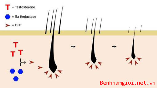 Rụng tóc do nguyên nhân nội tiết