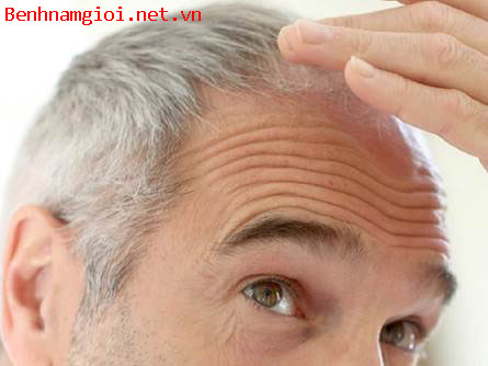 BoniHair - Giải pháp ưu việt cho người tóc bạc 