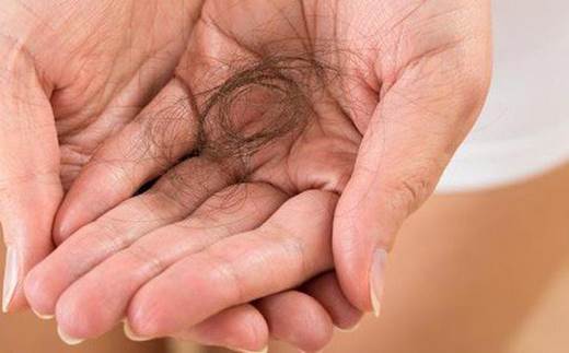 Rụng tóc nhiều có thể do thiếu sắt