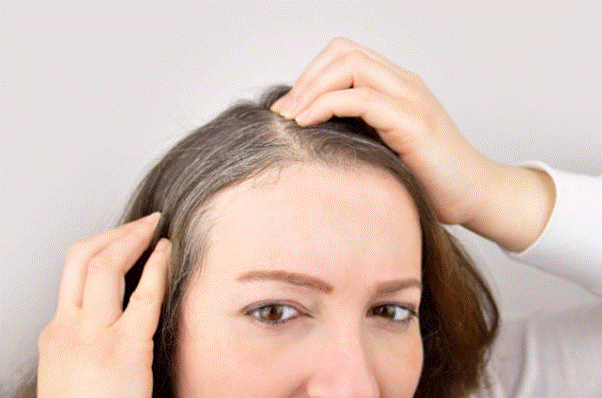 Cách chữa bạc tóc không cần nhuộm đơn giản tại nhà