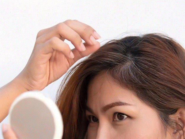 Tìm hiểu về tình trạng tóc bạc sớm ở nữ giới