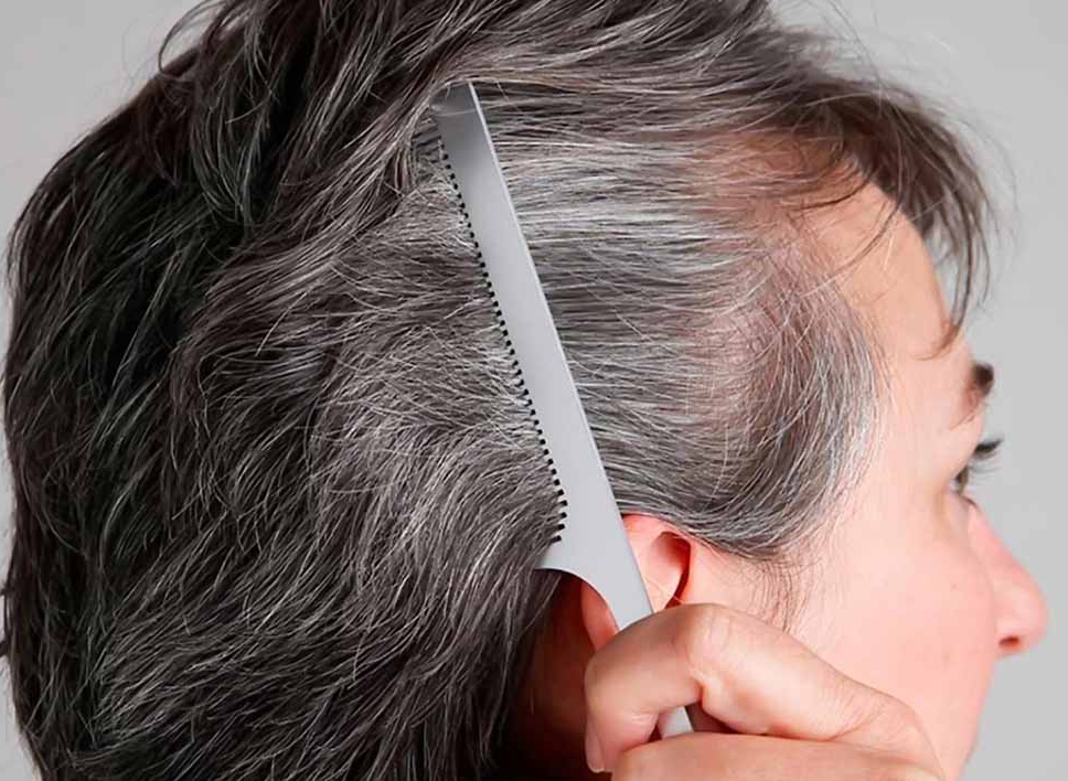 Sự lão hóa của tuổi tác khiến tóc bạc màu