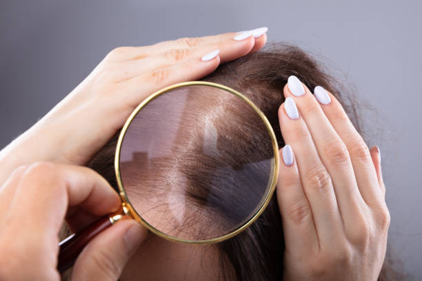 Các cách kích thích mọc tóc dân gian thường dùng là gì?