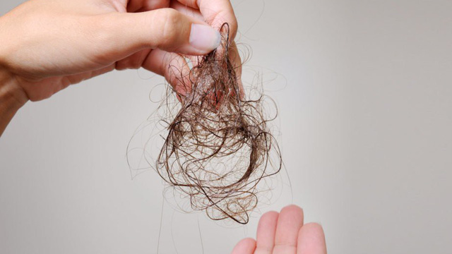 Vì sao tóc rụng nhiều hơn khi gội đầu?
