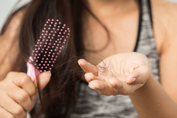 Mách bạn cách khắc phục tóc rụng nhiều đơn giản và hiệu quả
