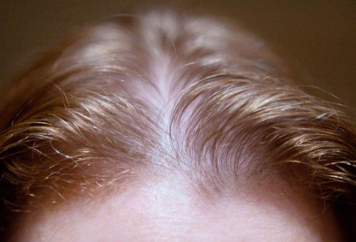 Bí kíp vàng khắc phục tóc thưa và mỏng bạn không nên bỏ lỡ