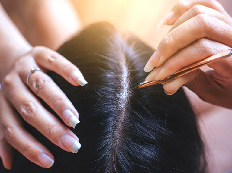 Top 3 hệ lụy khôn lường của thói quen nhổ tóc bạc - Giải pháp tối ưu cho người bạc tóc