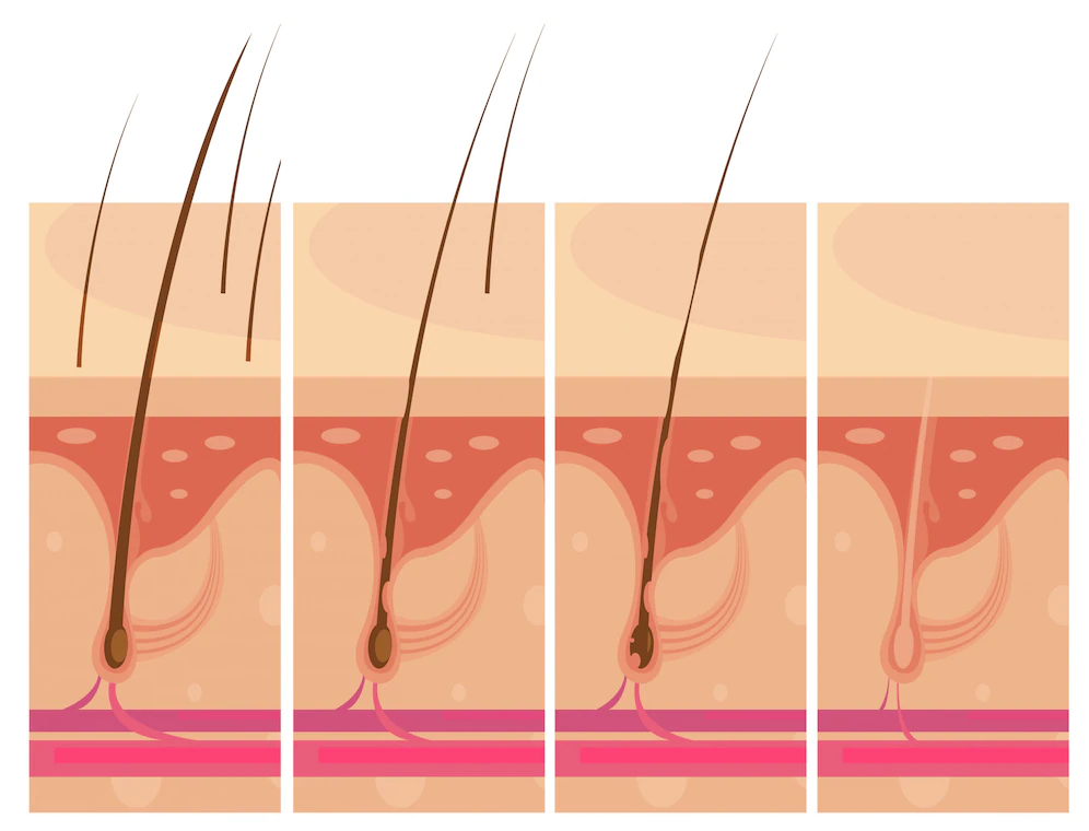 Massage da đầu thúc đẩy lưu thông máu tới nang tóc