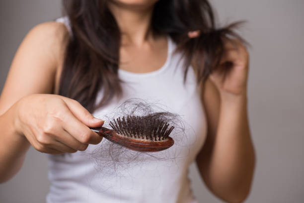Nguyên nhân gây rụng tóc thường gặp là gì?