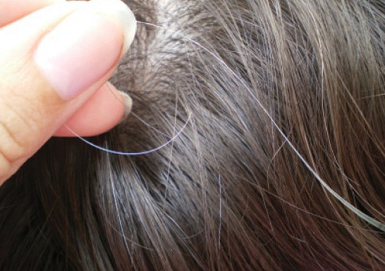 Đột phá mới của khoa học trong khắc phục tình trạng bạc tóc, bạn đã biết hay chưa?