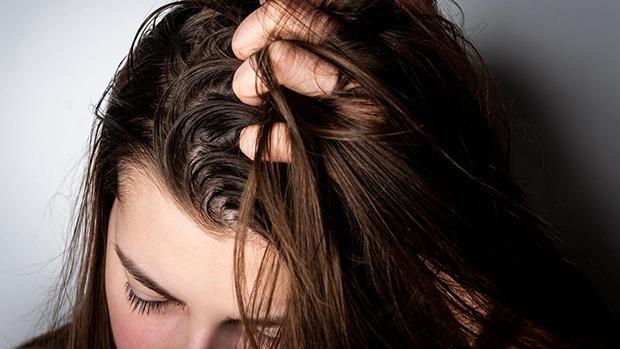 5 Mẹo giúp đẩy lui tình trạng tóc bóng dầu, dính bết vào mùa hè
