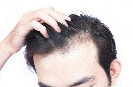  Nang tóc bị hư tổn sẽ khiến tóc mọc chậm